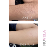 DEPILADORA LASER IPL PROFESIONAL